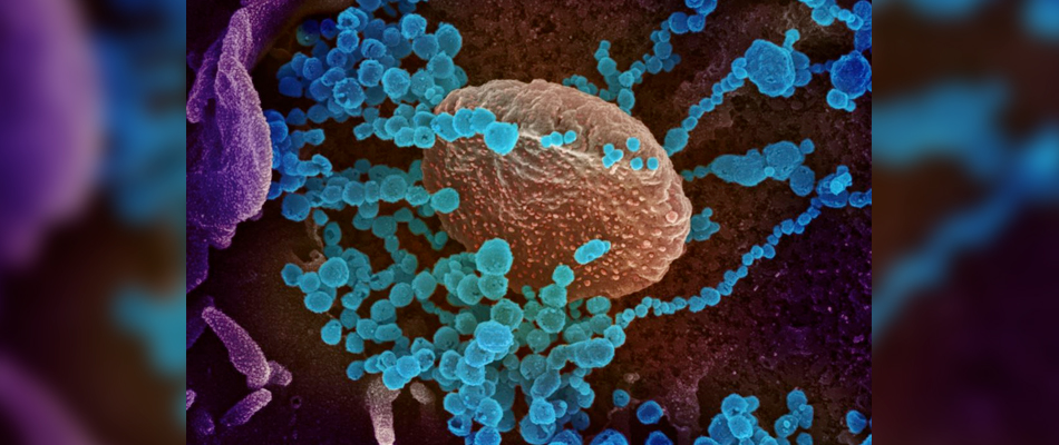 El COVID19 de cerca. Imagen: US National Institute of Allergy and Infectious Diseases